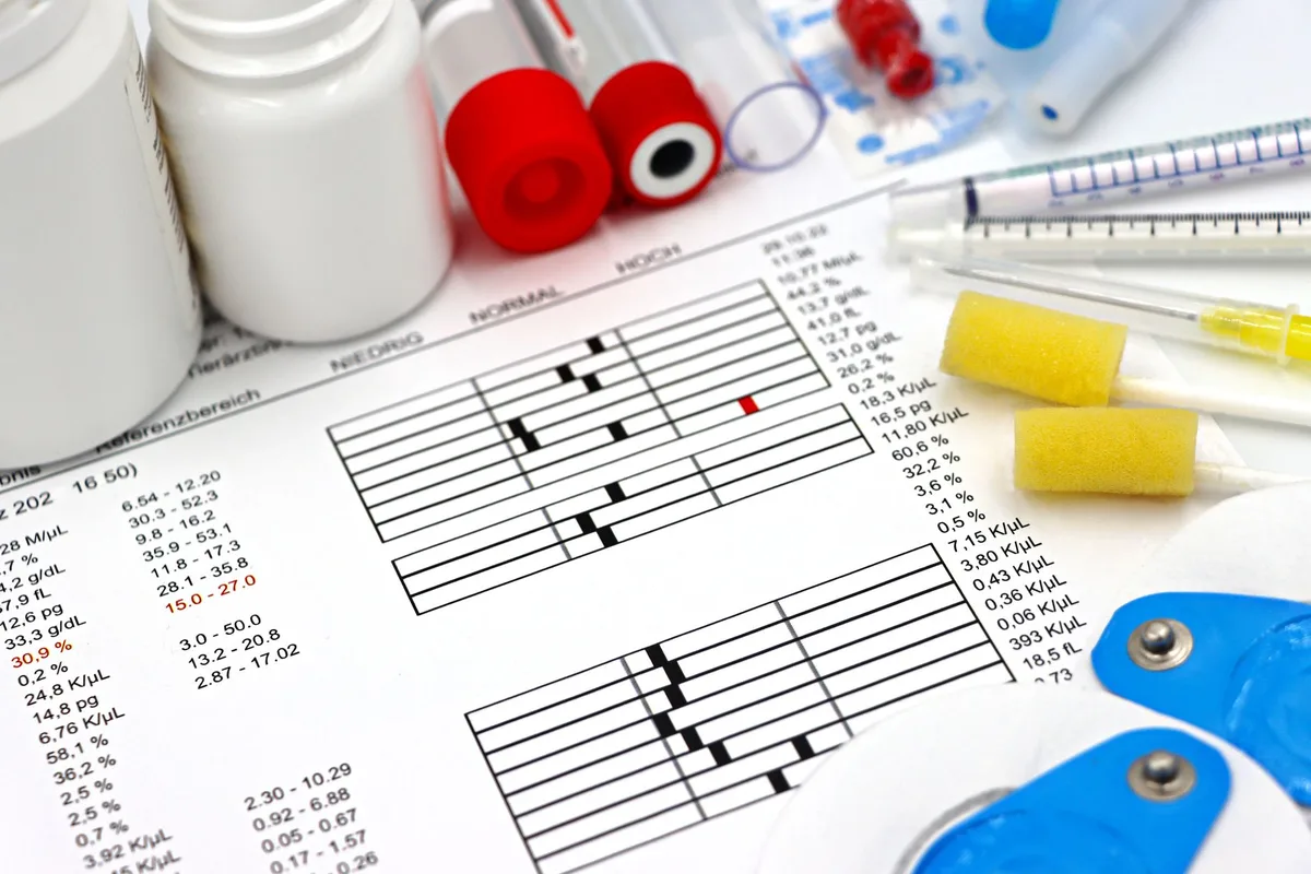Lipid panel blood test results showing LDL, HDL, triglycerides and total cholesterol values