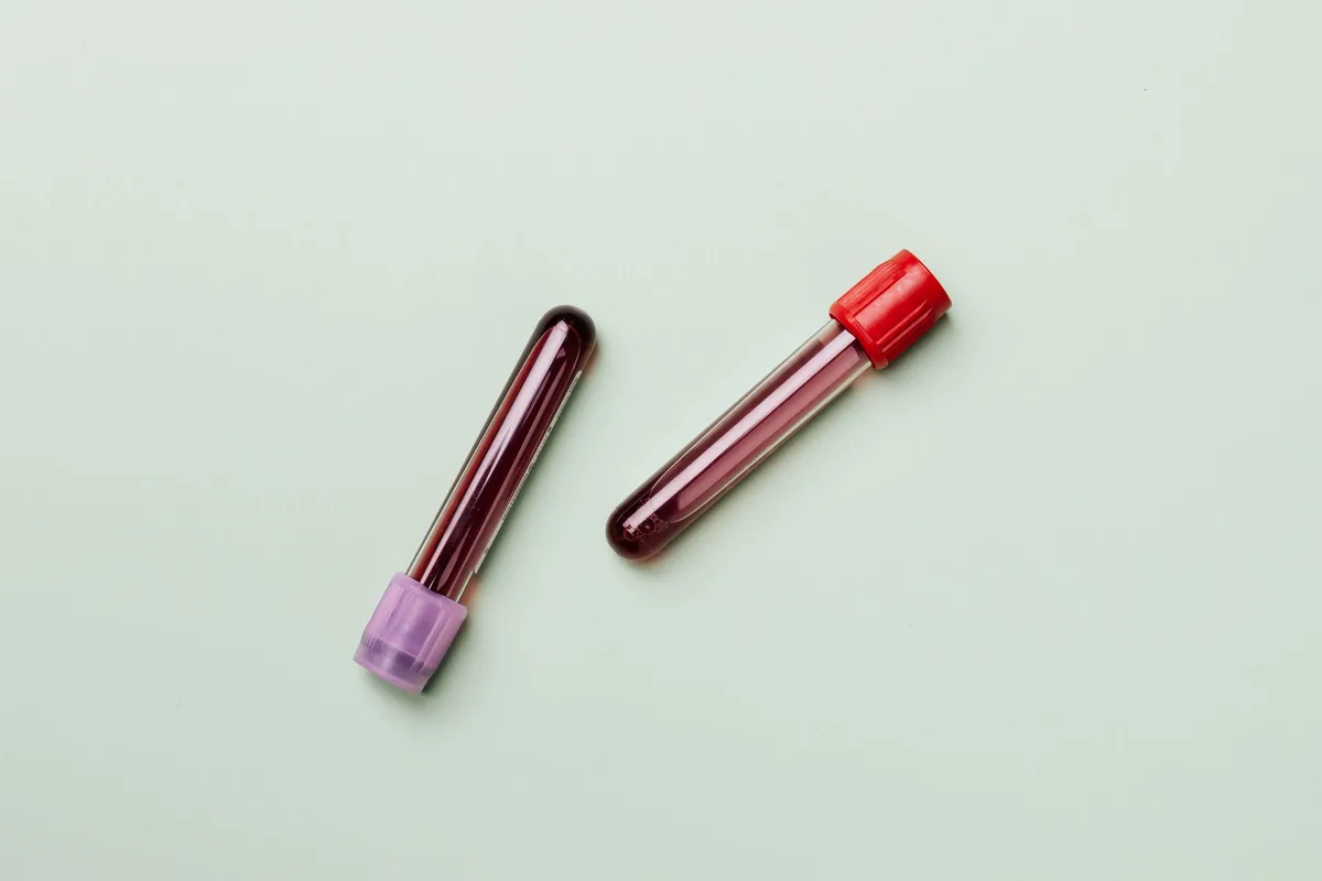 Blood sample in medical laboratory for hormone testing