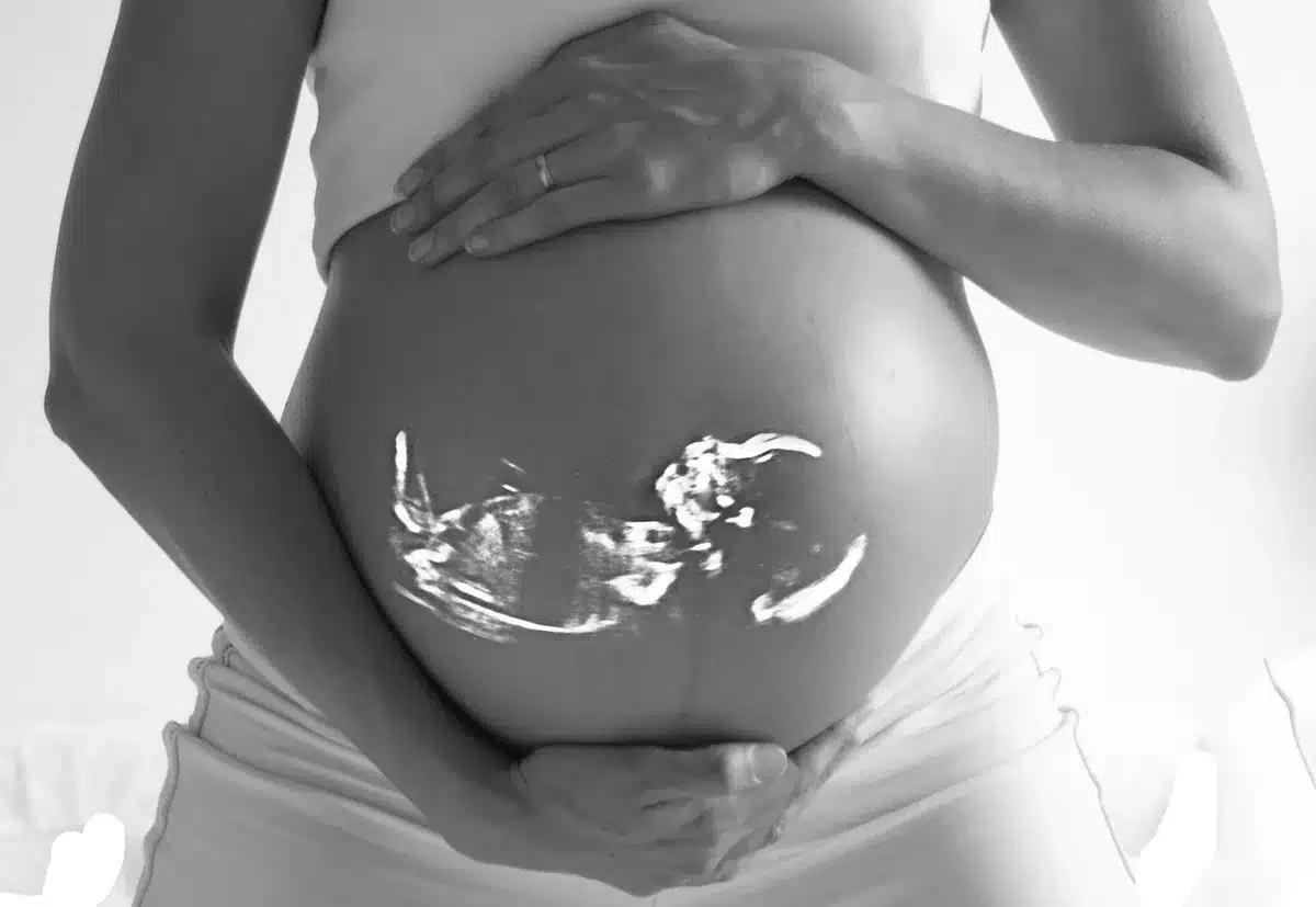Pregnant woman receiving prenatal ultrasound examination with healthcare provider